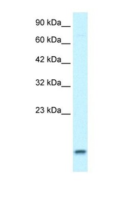 UBE2N/Ubc13 Antibody, Novus Biologicals 20&mu;L; Unlabeled:Antibodies,