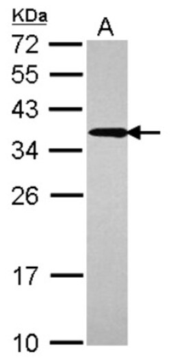 UBE2R2 Antibody, Novus Biologicals 0.1 mL | Buy Online | Novus Biologicals | Fisher Scientific
