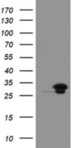 UBE2S Antibody (OTI1B5), Novus Biologicals 0.1mL; Unlabeled:Antibodies,