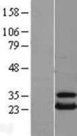 Novus Biologicals&trade;&nbsp;UBE2T Overexpression Lysate