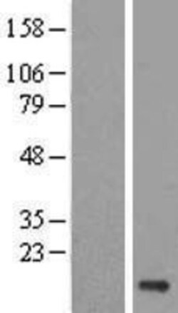 Novus Biologicals&trade;&nbsp;Uev1a/UBE2V1 Overexpression Lysate