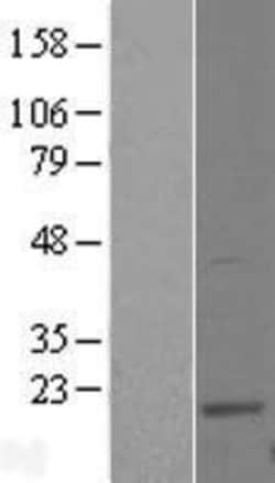 Novus Biologicals&trade;&nbsp;UBE2W Overexpression Lysate
