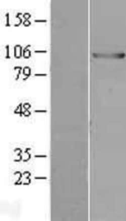 Novus Biologicals&trade;&nbsp;E6AP/UBE3A Overexpression Lysate