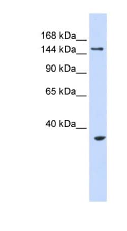 UBE3B Antibody, Novus Biologicals 0.05mg; Unlabeled:Antibodies, Polyclonal