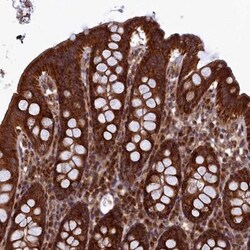 UBE3B Antibody, Novus Biologicals 25 &mu;L, Unlabeled:Antibodies, Polyclonal