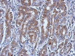 UBE4A Antibody, Novus Biologicals 0.1mL; Unlabeled:Antibodies, Polyclonal