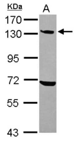 UBE4A Antibody, Novus Biologicals 0.1mL; Unlabeled:Antibodies, Polyclonal