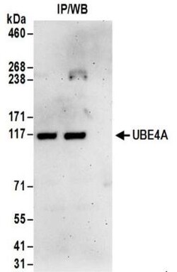 UBE4A Antibody, Novus Biologicals 100 &mu;L | Buy Online | Novus Biologicals | Fisher Scientific