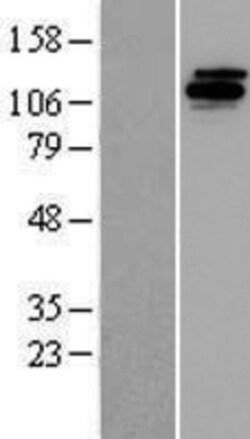 Novus Biologicals&trade;&nbsp;UBE4B Overexpression Lysate