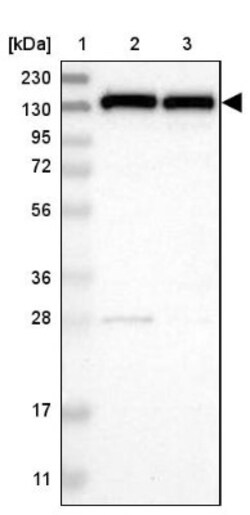 UBE4B Antibody, Novus Biologicals 25 &mu;L; Unlabeled:Antibodies, Polyclonal