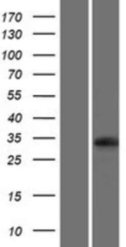 Novus Biologicals™ UBFD1 Overexpression Lysate