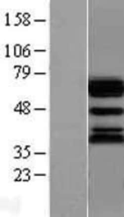 Novus Biologicals&trade;&nbsp;Ubiquilin 1 Overexpression Lysate