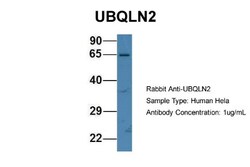 Ubiquilin 2 Antibody, Novus Biologicals 100&mu;L; Unlabeled:Antibodies,