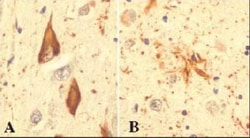 Ubiquitin Antibody (Ubi-1), Novus Biologicals:Antibodies:Primary Antibodies