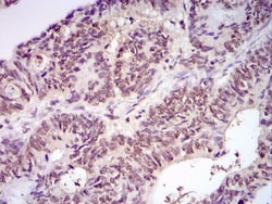 Ubiquitin Antibody (Ubi-1), Novus Biologicals:Antibodies:Primary Antibodies