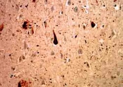 Ubiquitin Antibody (Ubi-1), Novus Biologicals:Antibodies:Primary Antibodies