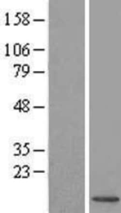 Novus Biologicals&trade;&nbsp;UBL3 Overexpression Lysate