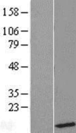 Novus Biologicals&trade;&nbsp;UBL5 Overexpression Lysate