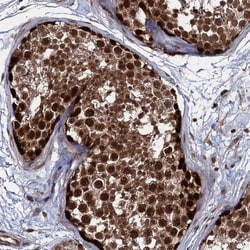 UBLCP1 Antibody, Novus Biologicals 0.1mL; Unlabeled:Antibodies, Polyclonal