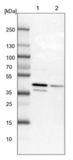 UBLCP1 Antibody, Novus Biologicals 0.1mL; Unlabeled:Antibodies, Polyclonal