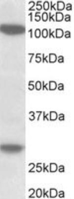 UBN1 Antibody, Novus Biologicals 0.1mg; Unlabeled:Antibodies, Polyclonal