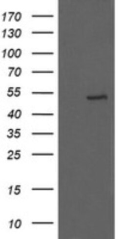 UBOX5 Antibody (OTI8D5), Novus Biologicals 0.1 mL | Buy Online | Novus Biologicals | Fisher Scientific