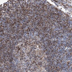 UBOX5 Antibody, Novus Biologicals 25ul | Buy Online | Novus Biologicals | Fisher Scientific