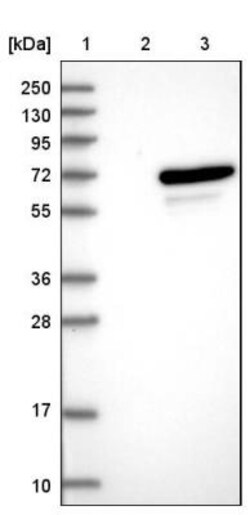 UBOX5 Antibody, Novus Biologicals 25ul | Buy Online | Novus Biologicals | Fisher Scientific