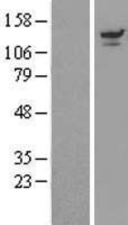 Novus Biologicals&trade;&nbsp;UBPY/USP8 Overexpression Lysate