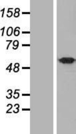 Novus Biologicals&trade;&nbsp;UBQLNL Overexpression Lysate