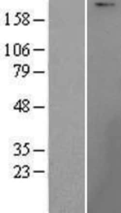 Novus Biologicals&trade;&nbsp;UBR1 Overexpression Lysate