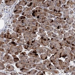 UBR1 Antibody, Novus Biologicals 0.1mL; Unlabeled:Antibodies, Polyclonal