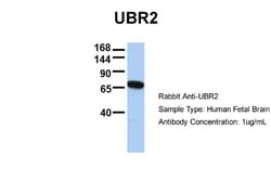 UBR2 Antibody, Novus Biologicals 100μL; Unlabeled:Antibodies, Polyclonal