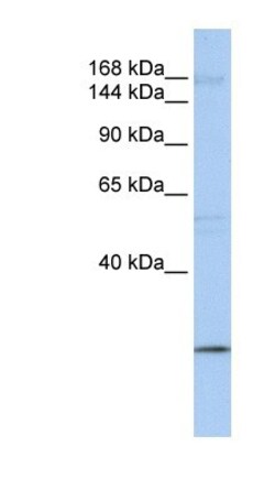 UBR2 Antibody, Novus Biologicals 100μL; Unlabeled:Antibodies, Polyclonal