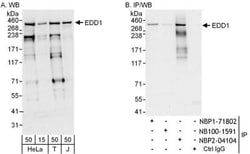 UBR5/EDD Antibody, Novus Biologicals 100 &mu;L | Buy Online | Novus Biologicals | Fisher Scientific