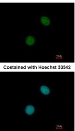 UBR7 Antibody, Novus Biologicals 0.1mL; Unlabeled:Antibodies, Polyclonal