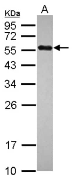 UBR7 Antibody, Novus Biologicals 0.1mL; Unlabeled:Antibodies, Polyclonal