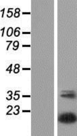 Novus Biologicals&trade;&nbsp;UBTD2 Overexpression Lysate