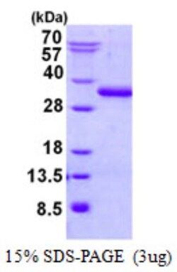 Novus Biologicals&trade;&nbsp;Recombinant Human UBTD2 His Protein