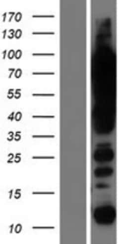 Novus Biologicals&trade;&nbsp;UBTF Overexpression Lysate