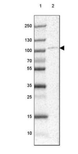 UBTF Antibody, Novus Biologicals 0.1 mL | Buy Online | Novus Biologicals | Fisher Scientific