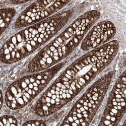 UBXD2 Antibody, Novus Biologicals 0.1mL; Unlabeled:Antibodies, Polyclonal