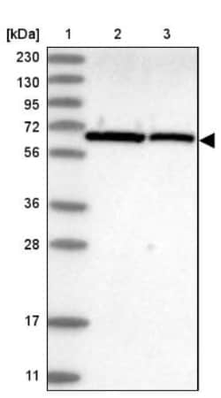 UBXD2 Antibody, Novus Biologicals 0.1mL; Unlabeled:Antibodies, Polyclonal