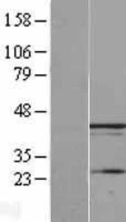 Novus Biologicals™ UBXN1 Overexpression Lysate