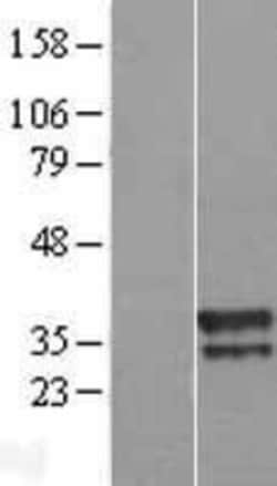 Novus Biologicals™ UBXN10 Overexpression Lysate