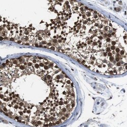 UBXN1 Antibody, Novus Biologicals:Antibodies:Primary Antibodies