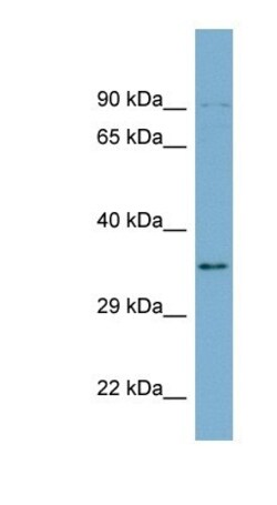 UBXN1 Antibody, Novus Biologicals 100&mu;L; Unlabeled:Antibodies, Polyclonal