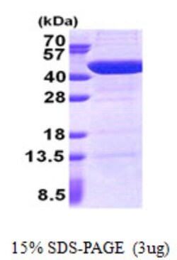 Novus Biologicals&trade;&nbsp;Recombinant Human UBXN2B His Protein