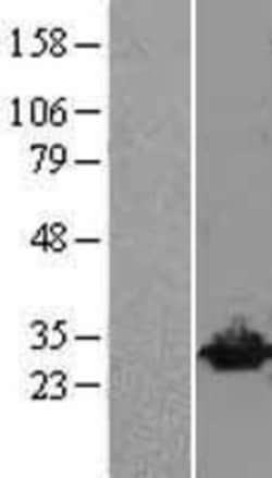 Novus Biologicals&trade;&nbsp;UCH-L3 Overexpression Lysate