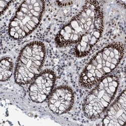UCK Antibody, Novus Biologicals:Antibodies:Primary Antibodies